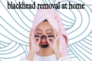 Blackhead removal at home by msbeautycare