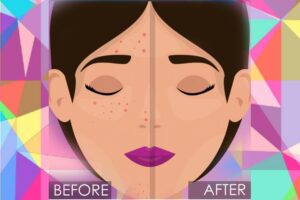 How to close open pores on face best tips by msbeautycare.com