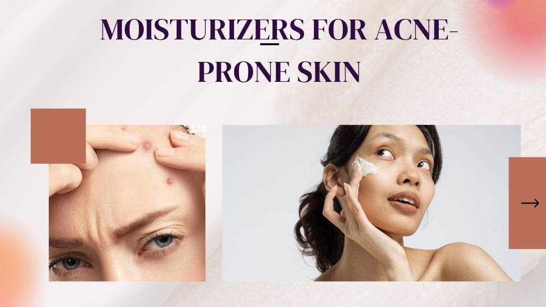 https://msbeautycare.com/best-moisturizer-for-acne-prone-skin/