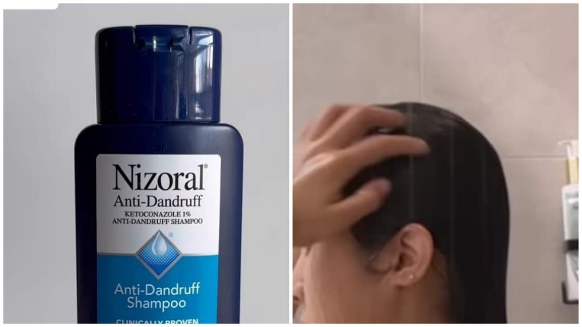 Best Shampoo For Hair Loss is Recommended by Dermatologiest