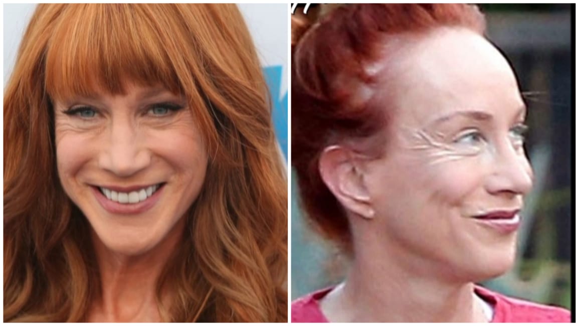 Kathy Griffin Steps Out Makeup-Free: A Bold Beauty Move