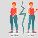 Weight Loss